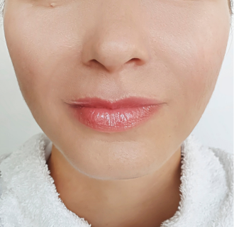 After — Face Toner result