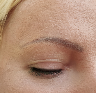 After — Under Eye Roller result