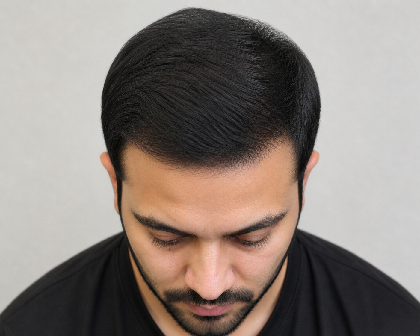 After — Retinol Night Serum result